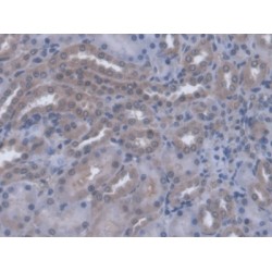 Lactosylceramide 4-Alpha-Galactosyltransferase (A4GALT) Antibody