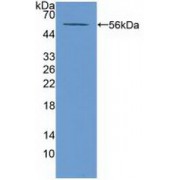 Western blot analysis of recombinant Mouse ABCA13.