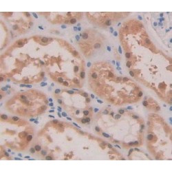 ATP Binding Cassette Transporter A2 (ABCA2) Antibody