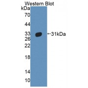 Western blot analysis of recombinant Human ABCB11 Protein.