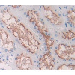 ATP Binding Cassette Subfamily B Member 7 (ABCB7) Antibody