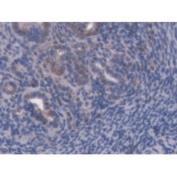 ATP Binding Cassette Transporter B8 (ABCB8) Antibody