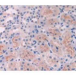 ATP Binding Cassette Transporter B8 (ABCB8) Antibody