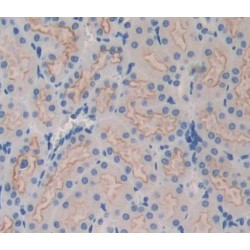 ATP Binding Cassette Transporter B9 (ABCB9) Antibody