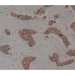 ATP Binding Cassette Transporter C11 (ABCC11) Antibody