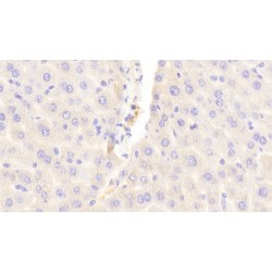 ATP Binding Cassette Transporter C6 (ABCC6) Antibody