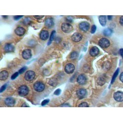 ATP Binding Cassette Transporter D4 (ABCD4) Antibody