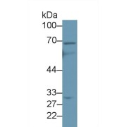 Western blot analysis of Human Jurkat cell lysate, using Human ABCD4 Antibody (2 µg/ml) and HRP-conjugated Goat Anti-Rabbit antibody (<a href="https://www.abbexa.com/index.php?route=product/search&amp;search=abx400043" target="_blank">abx400043</a>, 0.2 µg/ml).