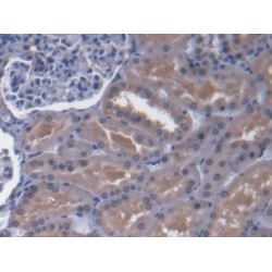 ATP Binding Cassette Transporter D4 (ABCD4) Antibody