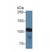 Western blot analysis of Human HeLa cell lysate, using Human ABCF1 Antibody (3 µg/ml) and HRP-conjugated Goat Anti-Rabbit antibody (<a href="https://www.abbexa.com/index.php?route=product/search&amp;search=abx400043" target="_blank">abx400043</a>, 0.2 µg/ml).