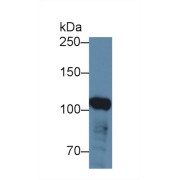 Western blot analysis of Human HeLa cell lysate, using Human ABCF1 Antibody (3 µg/ml) and HRP-conjugated Goat Anti-Rabbit antibody (<a href="https://www.abbexa.com/index.php?route=product/search&amp;search=abx400043" target="_blank">abx400043</a>, 0.2 µg/ml).