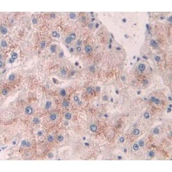 ATP Binding Cassette Subfamily G Member 4 (ABCG4) Antibody