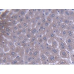 Acetyl Coenzyme A Acyltransferase 1 (ACAA1) Antibody