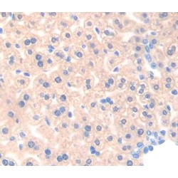 Acetyl Coenzyme A Acyltransferase 1 (ACAA1) Antibody