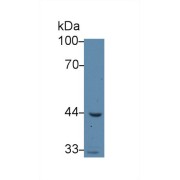 abx130588