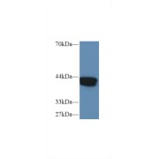 Western blot analysis of Human MCF7 cell lysate, using Human IVD Antibody (1 µg/ml) and HRP-conjugated Goat Anti-Rabbit antibody (<a href="https://www.abbexa.com/index.php?route=product/search&amp;search=abx400043" target="_blank">abx400043</a>, 0.2 µg/ml).