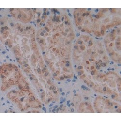 Isovaleryl Coenzyme A Dehydrogenase (IVD) Antibody