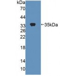 Carboxylesterase 1 (CES1) Antibody