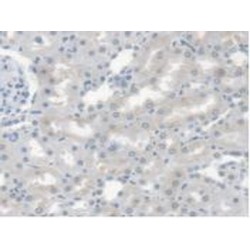 Carboxylesterase 1 (CES1) Antibody