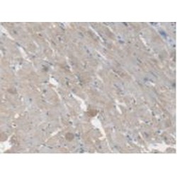 Carboxylesterase 1 (CES1) Antibody