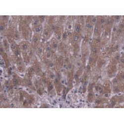 Carboxylesterase 1 (CES1) Antibody