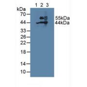 Western blot analysis of (1) Human HepG2 Cells, (2) Porcine Liver Tissue and (3) Mouse Liver Tissue.