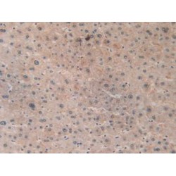 Acetyl Coenzyme A Acetyltransferase 2 (ACAT2) Antibody