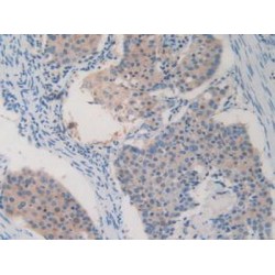 Acetyl Coenzyme A Acetyltransferase 2 (ACAT2) Antibody