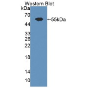 abx130604
