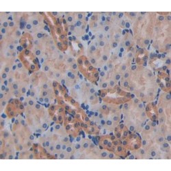 Actin Filament Associated Protein 1 (AFAP1) Antibody