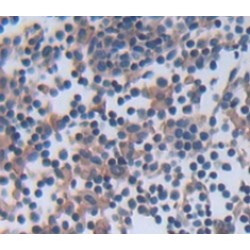 Bruton'S Tyrosine Kinase (Btk) Antibody
