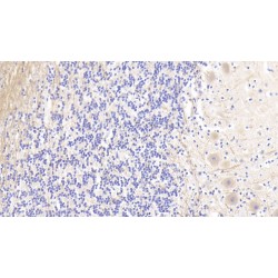 Agrin (AGRN) Antibody