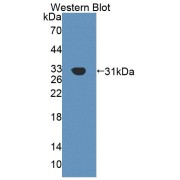 abx130616