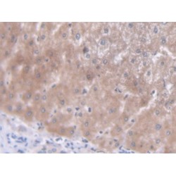 Three Prime Repair Exonuclease 1 (TREX1) Antibody