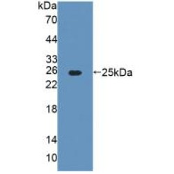 Alanine Glyoxylate Aminotransferase (AGXT) Antibody