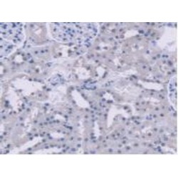 Alanine Glyoxylate Aminotransferase 2 (AGXT2) Antibody