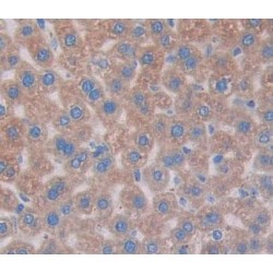 Alanine Glyoxylate Aminotransferase 2 (AGXT2) Antibody