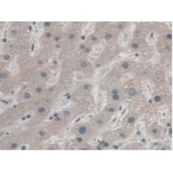 Aspartylglucosaminidase (AGA) Antibody