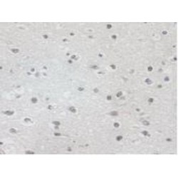 Aspartylglucosaminidase (AGA) Antibody