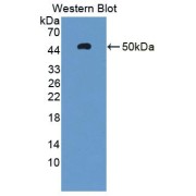 abx130625
