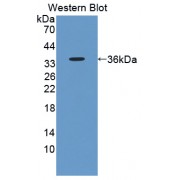 Western blot analysis of recombinant protein human AKAP12.