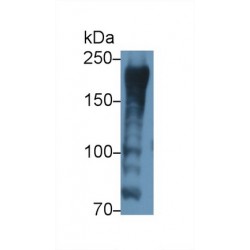 A Kinase Anchor Protein 12 (AKAP12) Antibody