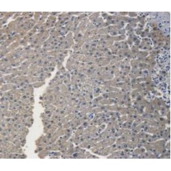 Retinal Dehydrogenase 1 (ALDH1A1) Antibody