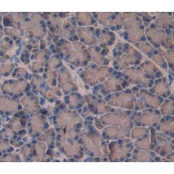 Amphiphysin (AMPH) Antibody