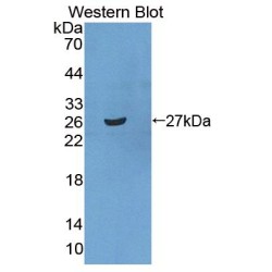 Signal Recognition Particle Receptor B (SRPRB) Antibody
