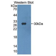 abx130665