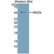 Western blot analysis of recombinant Human DSG2 protein.