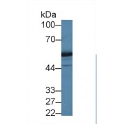 Western blot analysis of Human Jurkat cell lysate, using Human DARS Antibody (1 µg/ml) and HRP-conjugated Goat Anti-Rabbit antibody (<a href="https://www.abbexa.com/index.php?route=product/search&amp;search=abx400043" target="_blank">abx400043</a>, 0.2 µg/ml).