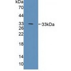 B-Lymphocyte Antigen CD19 (CD19) Antibody
