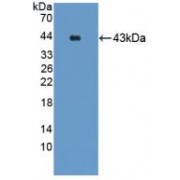 Western blot analysis of recombinant Mouse GRPR.